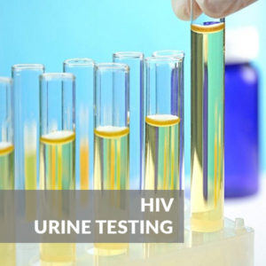 HIV Urine Test